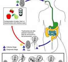 Cronică (forța de tracțiune) giardioza la adulți și copii