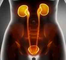 Infecții ale tractului urinar la femei, simptome, tratament, cauze, simptome