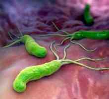 Infectarea cu Helicobacter pylori: tratament, simptome, cauze, diagnostic, simptome