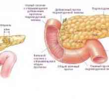 Insulinom cancer pancreatic: simptome, diagnostic, tratament, simptome, cauze