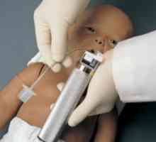 Intubație neonatală: Pipe Tehnologie intubarea