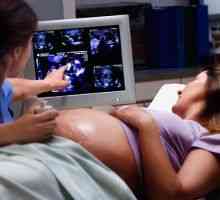 Valve biologice artificiale în timpul sarcinii