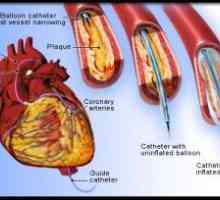 Un studiu al arterelor