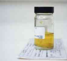 Analiza urinei, analiza urinei