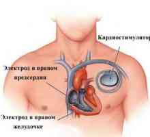 Bate inima ventricul tratament, cauze, simptome