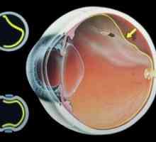 Embriogenezei retinei