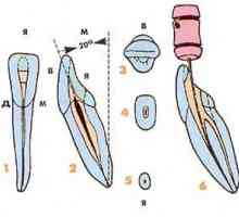 Aspecte endodontic ale morfologiei dinților permanenți inferiori