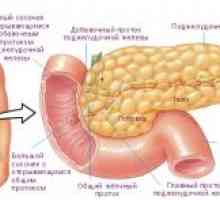 Endocrine tumorală a pancreasului
