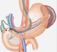 Endosonography Endouzi și pancreas