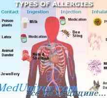 Epidemiologie (prevalenta) boli alergice atopie