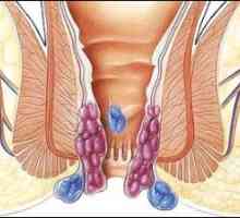 Esofagita și gastropatia eritematoasă