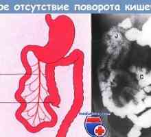 Etapele de dezvoltare a intestinului. Rotire (răspândirea) intestin fetal