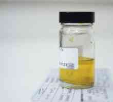Cum de a colecta o mostră de urină?