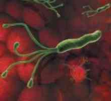 Ce bacterii cauzeaza ulcere stomacale? Helicobacter pylori, agentul cauzal al ulcerului peptic