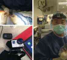 GoPro aparat de fotografiat pentru a instrui chirurgii