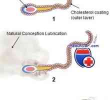 Sperma capacitația. reacția Hiperactivarea și acrosomalproteinaza