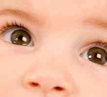Cataracta la copii: tratament, cauze, simptome, semne