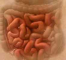 Enterocolită infectie intestinala