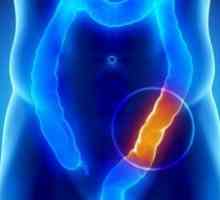 Obstrucție intestinală: simptome, tratament, diagnostic, cauze, simptome, clasificarea