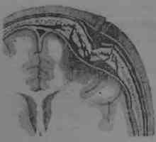 Clasificarea leziunilor provocate de gloanțe ale craniului si a creierului