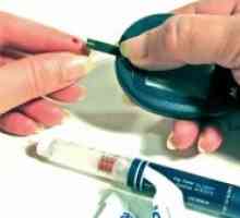 Clasificarea diabetului zaharat