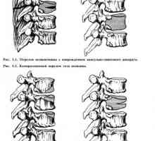Clasificarea leziunilor coloanei vertebrale și a măduvei spinării