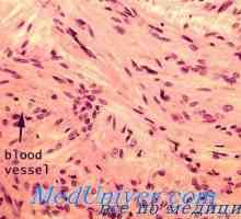 Compoziția celulară a hipotalamusului. Efectul de hipoxie asupra celulelor paraventricular și…