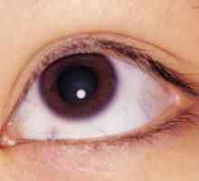 Ochi cheratită limită: tratament, cauze, simptome
