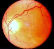 Alimentarea cu sânge a retinei