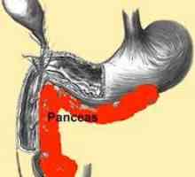 Tratament de pancreatită (pancreatic), în faza acută