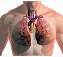 Supurație pulmonară