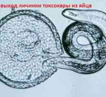 Larvele și ouă Toxocara toxocarioza viscerala