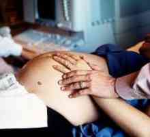 Listerioza în timpul sarcinii, simptome, tratament