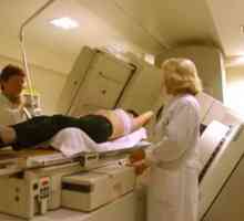 Diagnosticul radiologic al stomacului și intestinelor