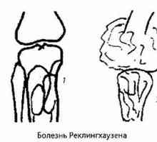 Radiații si diagnostic instrumental al genunchiului patologiei articulare. artrită