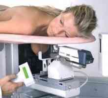San mamografie atunci când fac?