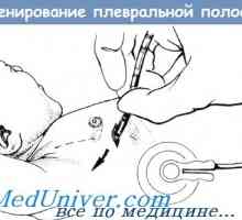 Metode de drenaj cavitatea pleurală a unui copil nou-născut în spatele
