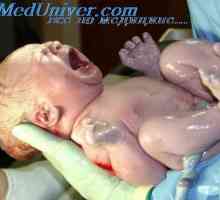 Trecerea la nou-născut de respirație spontană. Netezirea plămâni după naștere
