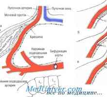 Metode de cateterizare arterei ombilicale. Aparate de montaj artera ombilicala cateter in