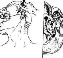 Metodele analgezie mandibular