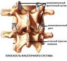 Intervertebrale (dugootroschatye) articulații