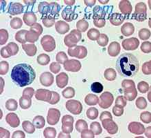 Distrugerea hemoglobinei. varietate de anemii