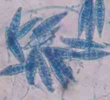 Microsporidioza la oameni: simptome, tratament