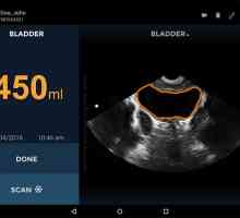 Scaner cu ultrasunete miniatură pentru urologi