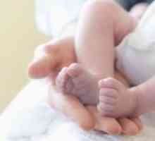 Mai multe copii artrogripsozei congenitale