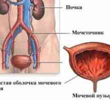 Sindromul urinar: Simptome, Diagnostic, Tratament, cauzele