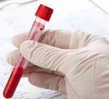 Poate fi hemoglobina scăzută și creșterea vitezei de sedimentare a hematiilor de hemoroizi?