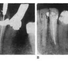 Morfologie și principii dinte endodontic