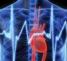 Încălcarea conducerii cardiace, bloc cardiac, picioare, tratament, simptome, cauze