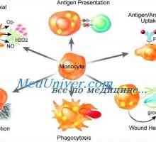 Disfuncția de monocite și macrofage imunitate